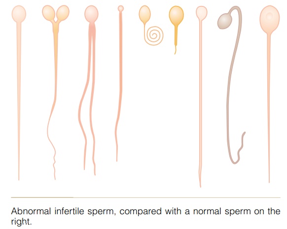 Abnormal Spermatogenesis and Male Fertility