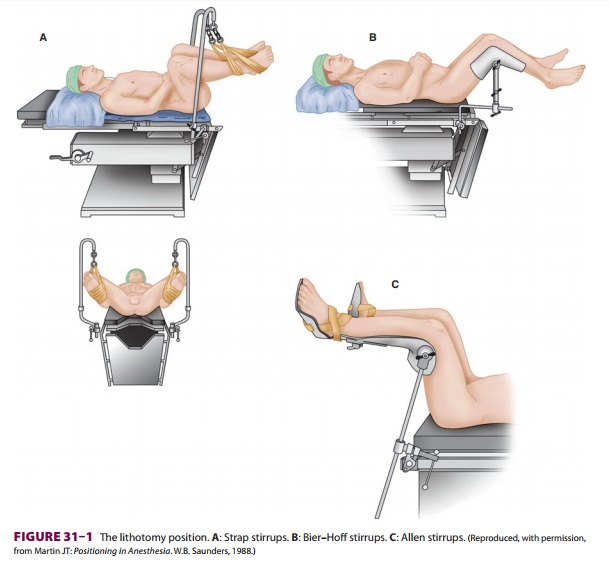 Anesthesia for Cystoscopy