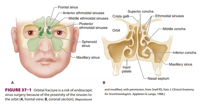 Anesthesia for Nasal & Sinus Surgery