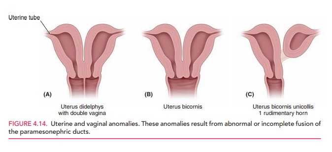 Anomalies of the Female Reproductive System