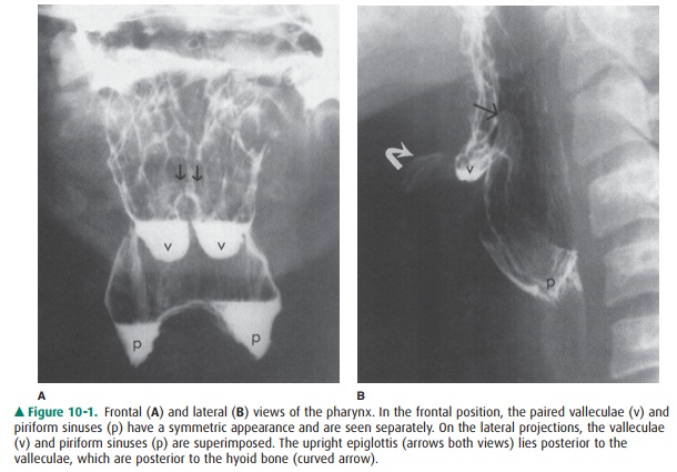 Basic Radiology : Gastrointestinal Tract