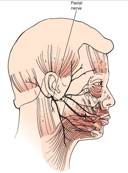 Bell’s Palsy - Cranial Nerve Disorders