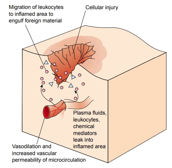 Cellular Response to Injury: Inflammation