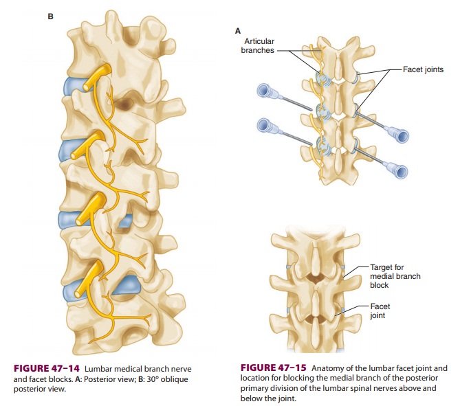 Cervical, Thoracic & Lumbar Medial Branch Blocks