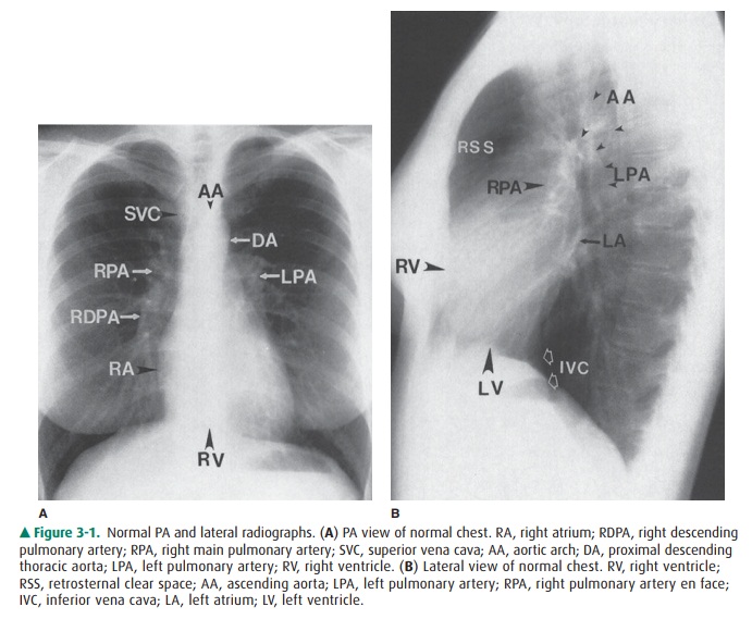 Conventional Radiographs