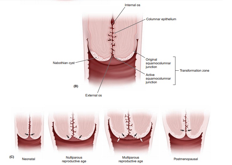 Etiology of Cervical Intraepithelial Neoplasia