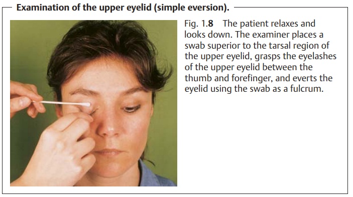 Examination of the Conjunctiva