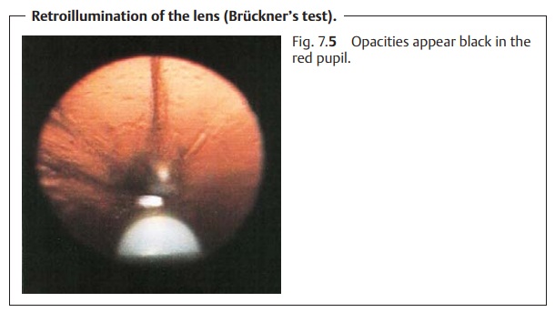 Eye Lens: Examination Methods