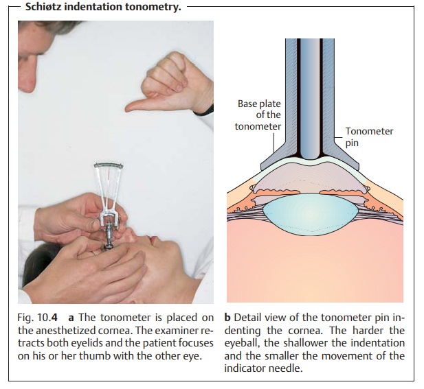 Glaucoma: Examination Methods