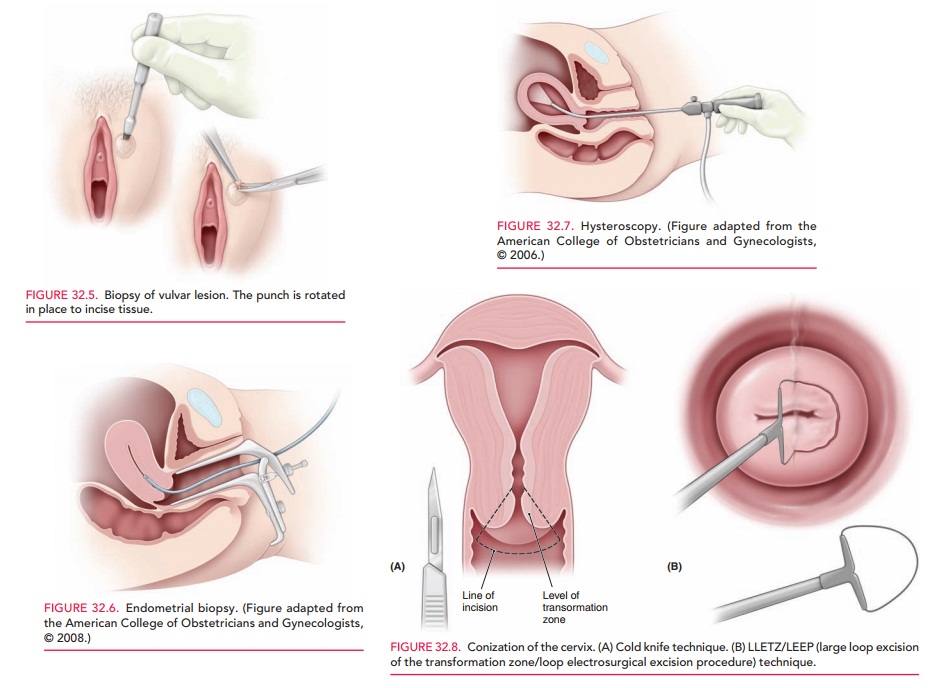Gynecological Procedures