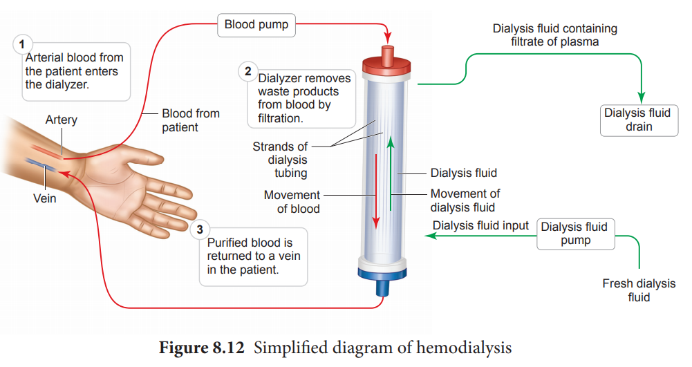 Haemodialysis