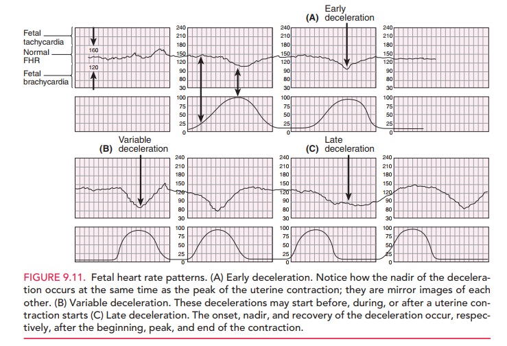 Intrapartum Fetal Heart Rate Monitoring