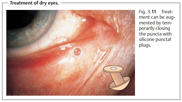 Lacrimal System Dysfunction