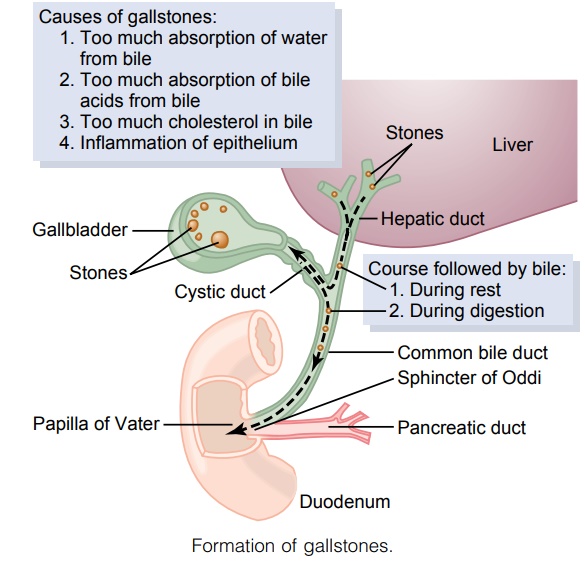 Liver Secretion of Cholesterol and Gallstone Formation