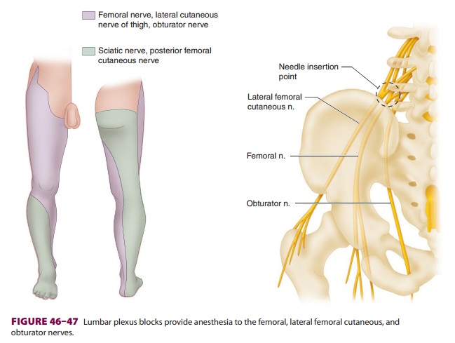 Lower Extremity Peripheral Nerve Blocks: Posterior Lumbar Plexus (Psoas Compartment) Block