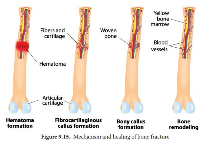 Mechanism and healing of a bone fracture