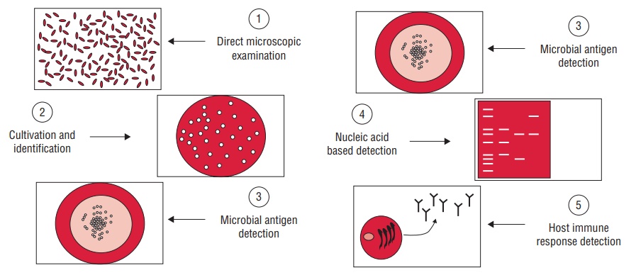Methods of Laboratory Diagnosis of Viral Diseases