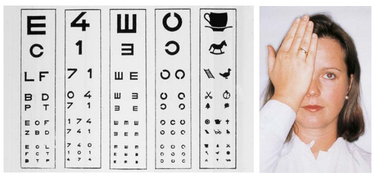 Ophthalmic Examination: Visual Acuity
