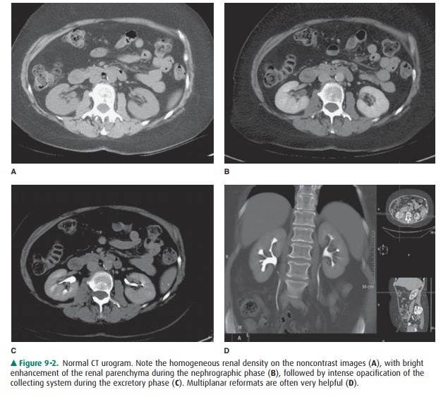 Radiology of the Urinary Tract
