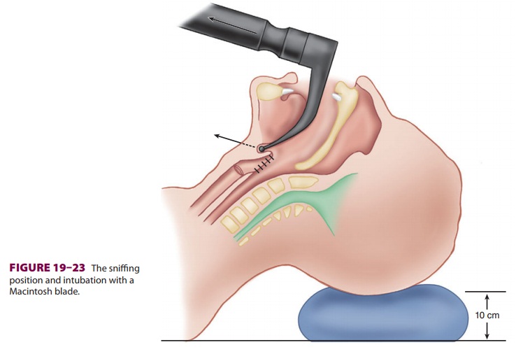 Techniques of Direct and Indirect Laryngoscopy & Intubation