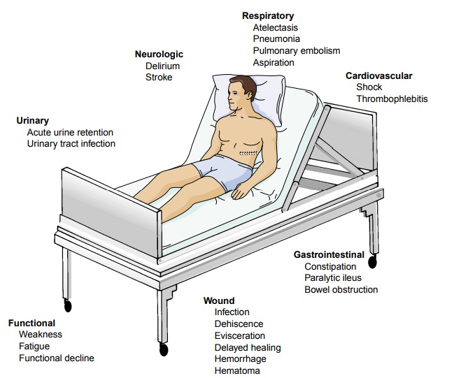 The Hospitalized Postoperative Patient