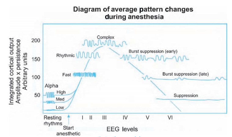 The electroencephalogram and evoked responses - Anesthesia Clinical management