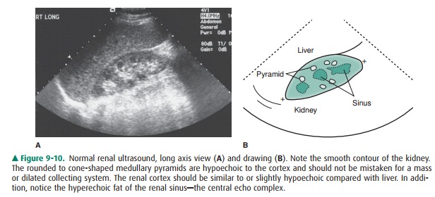 Ultrasonography - Radiology of the Urinary Tract: Techniques and Normal Anatomy