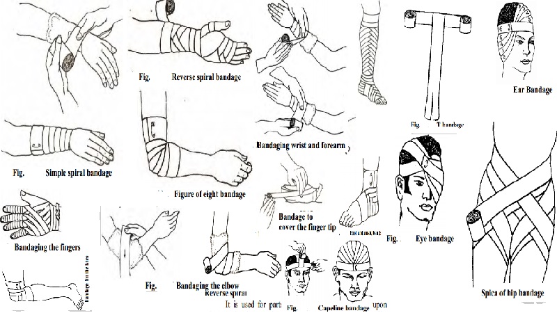 Uses, Guidelines and Types of bandages.