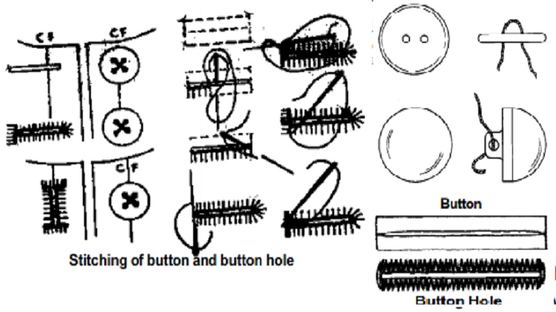 Buttons and Buttonholes