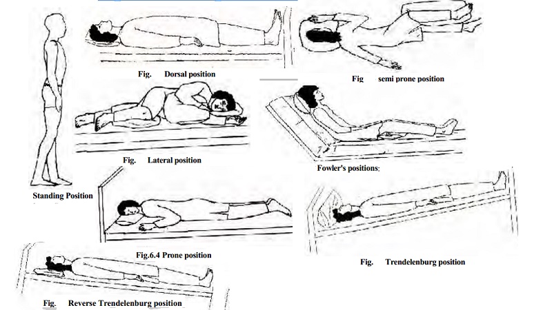 lateral position nursing