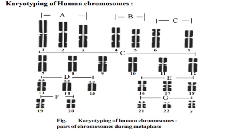 Human Genetics - Karyotyping