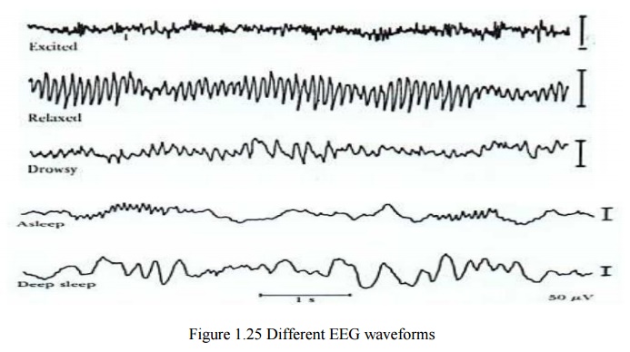 Electro Encephalo Gram (EEG)