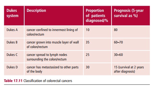 Dukes Staging System For Colorectal Cancer BKZPKO Dukes Staging System For Colorectal Cancer BKZPKO