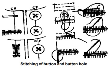 Buttons and Buttonholes
