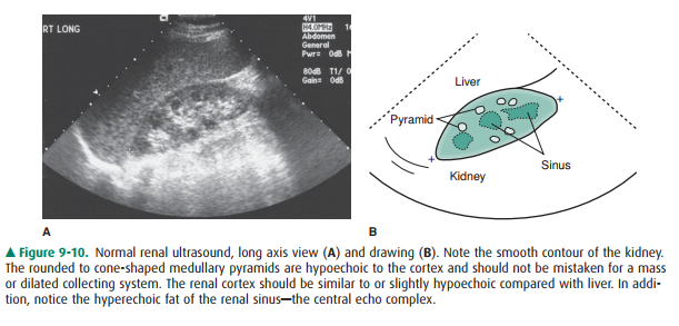 Leonardoda basin corner Ultrasonography - Radiology of the Urinary Tract: Techniques and Normal  Anatomy