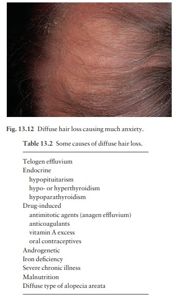Diffuse hair loss