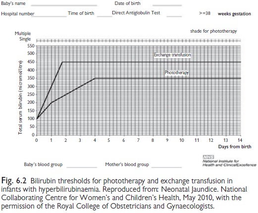 Neonatal Jaundice Chart Malaysia
